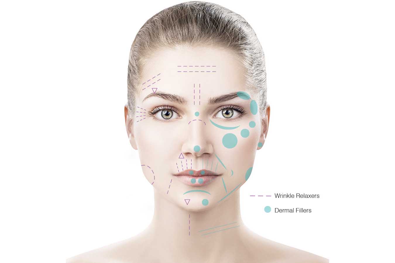 Cosmetic Injections in NYC
